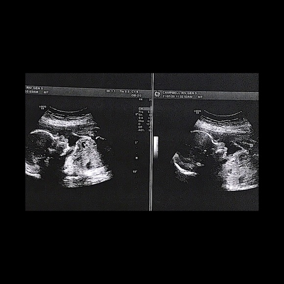 Meet your Posher, Dawn - Picture 3 of 3